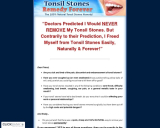 Tonsil Stones Remedy Forever ~ Brand New With a 11.2% Conversion Rate!